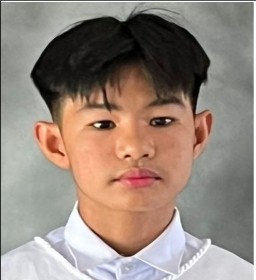 Kobe Jacque Mitchell C. Ochinang Md.